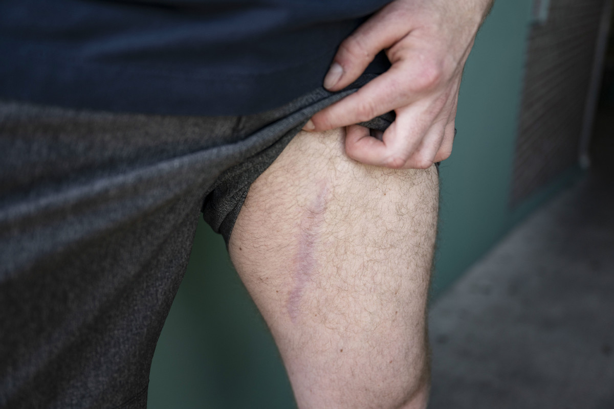 A decade later, the bullet is still inside Donohue’s leg.